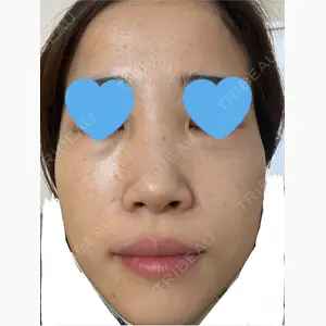 ハナビューティークリニック口コミ