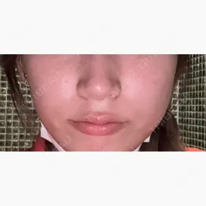 ルラ美容クリニック 福岡天神院口コミ