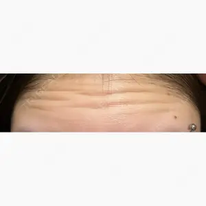 エスクリニック 恵比寿口コミ