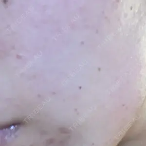 ルラ美容クリニック 福岡本院口コミ