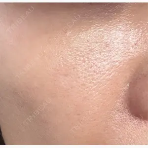 ゆきスキンクリニック 東池袋口コミ