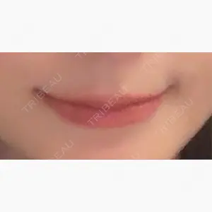 お茶の水美容形成クリニック口コミ