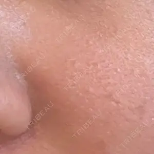 ライズワン美容皮膚科クリニック口コミ