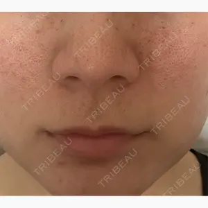 東京美容外科 福岡院口コミ