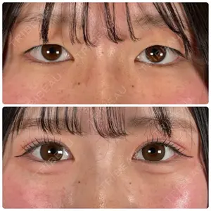 神戸美容外科 ネビュラクリニック口コミ