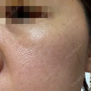 Chloe Cheongdam Clinic （クロエチョンダムクリニック）口コミ