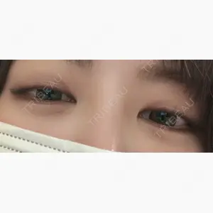 フィラークリニック 新宿院口コミ