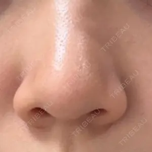 eクリニック 福岡院口コミ