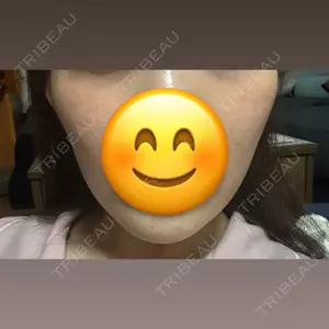 ビューティー和心クリニック 浅草院口コミ