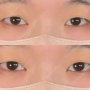 アリエル美容クリニック 大宮院口コミ