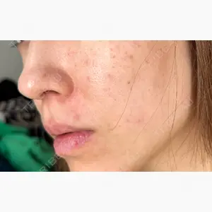 ルラ美容クリニック 静岡院口コミ