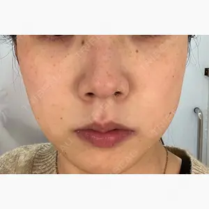 ルラ美容クリニック 上野院口コミ