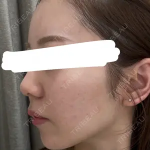 DaysBeautyClinic 銀座院口コミ