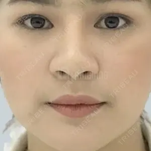 TCB東京中央美容外科 なんば院口コミ