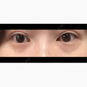 DaysBeautyClinic 銀座院口コミ