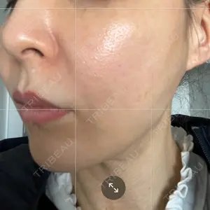 ゆきスキンクリニック 東池袋口コミ