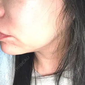 広島本通り美容クリニック口コミ