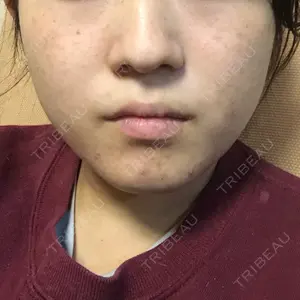 ライズワン美容皮膚科クリニック口コミ