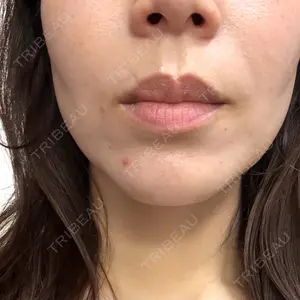 つだ美容外科クリニック口コミ