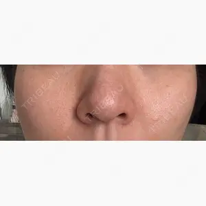 CHARIS BEAUTY CLINIC口コミ
