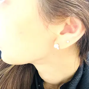 東京美容外科 札幌院口コミ