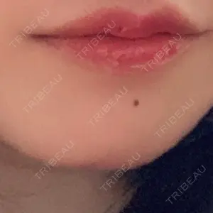 PRO CLINIC プロクリニック 銀座院口コミ