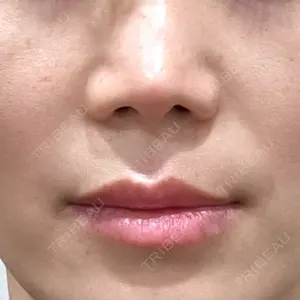 EMMO FACE CLINIC 東京三田院口コミ