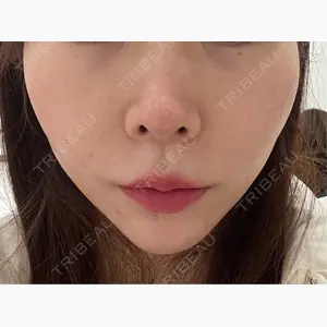 ルラ美容クリニック 名古屋栄院 / ルラスキンクリニック 名古屋栄院口コミ