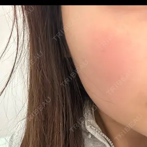 ルラ美容クリニック 上野院口コミ