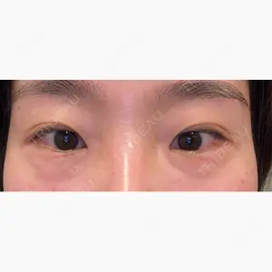 ハナビューティークリニック口コミ