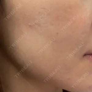 L‘amour clinic Tokyo【ラムールクリニック東京】口コミ