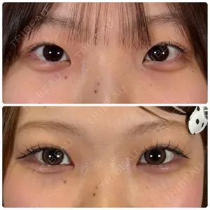 神戸美容外科 ネビュラクリニック口コミ