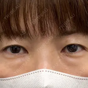 ネビュラクリニック 京都院口コミ