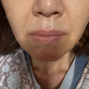 おおかみ美容のクリニック 新宿院口コミ