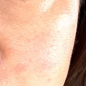 ルラ美容クリニック 名古屋本院口コミ