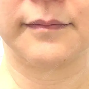 しんゆり美容健康クリニック口コミ