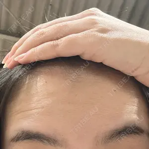 池袋美容クリニック口コミ