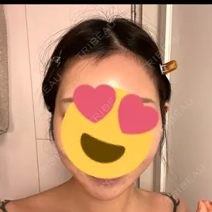 PRO CLINIC プロクリニック 銀座院口コミ