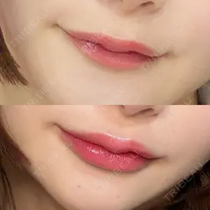 ルラ美容クリニック 名古屋栄院 / ルラスキンクリニック 名古屋栄院口コミ