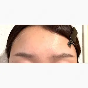 TCB東京中央美容外科 立川院口コミ