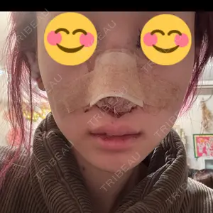 グローバルビューティークリニック 大阪院口コミ