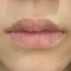藤・ナチュレ美容クリニック 銀座院口コミ