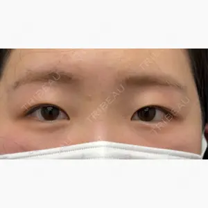 ネビュラクリニック 京都院口コミ