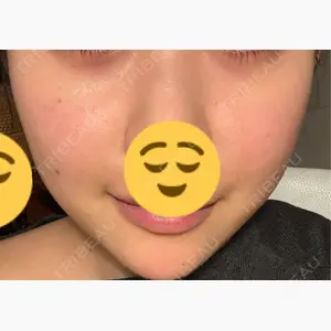 ミニマムスキンクリニック銀座口コミ