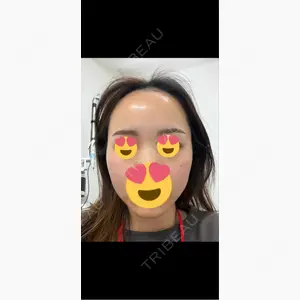 TCB東京中央美容外科 京都駅前院口コミ