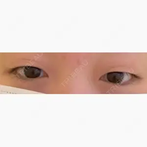 アリエル美容クリニック 郡山院口コミ