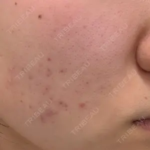 ルラ美容クリニック 京都院口コミ