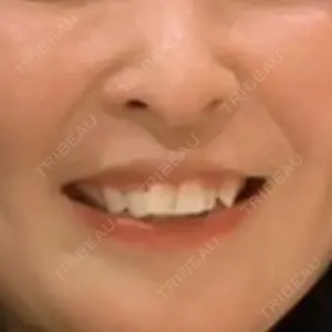 TCB東京中央美容外科 神戸院口コミ
