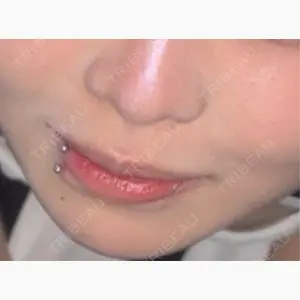 ルラ美容クリニック 名古屋本院口コミ