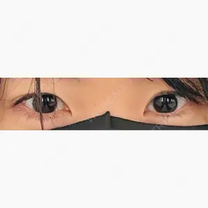 TCB東京中央美容外科 川越院口コミ